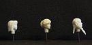 kop004_Sied_001_002_003